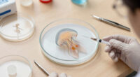 Jellyfish Can Heal Wounds In Minutes. Scientists Want Their Secrets